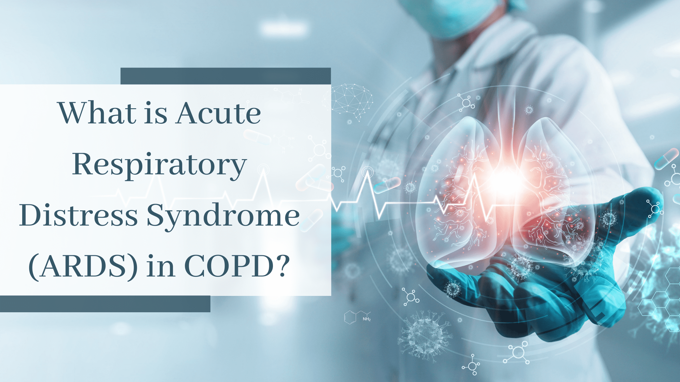What Is Acute Respiratory Distress Syndrome